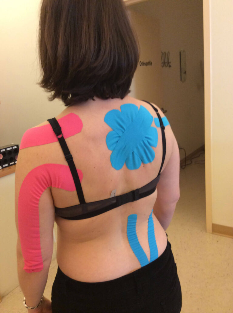 K-Taping : à quoi sert le taping kinésiologique ?